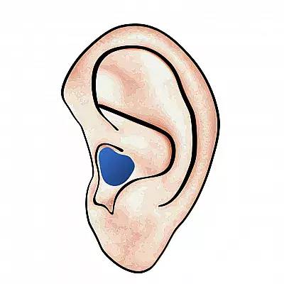 Hörgeräte im Ohr