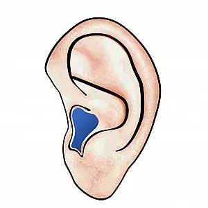 Hörgeräte auf dem Ohr